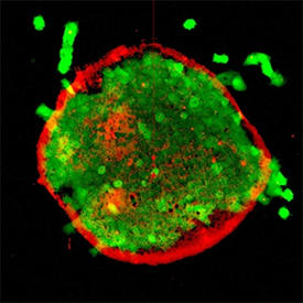 高分子ナノシート（赤色）上の網膜色素上皮細胞（緑色）単層。