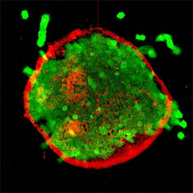 Monolayer of retinal pigment epithelium cells (green) on a polymer nanosheet (red).