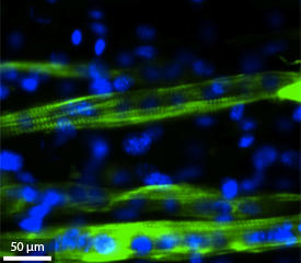 カーボンナノチューブを担持したハイドロゲルに溝を刻み、その中で筋芽細胞（緑色）を整列させると、筋芽細胞が融合して筋管細胞を形成する。青色に染まっているのは細胞核。